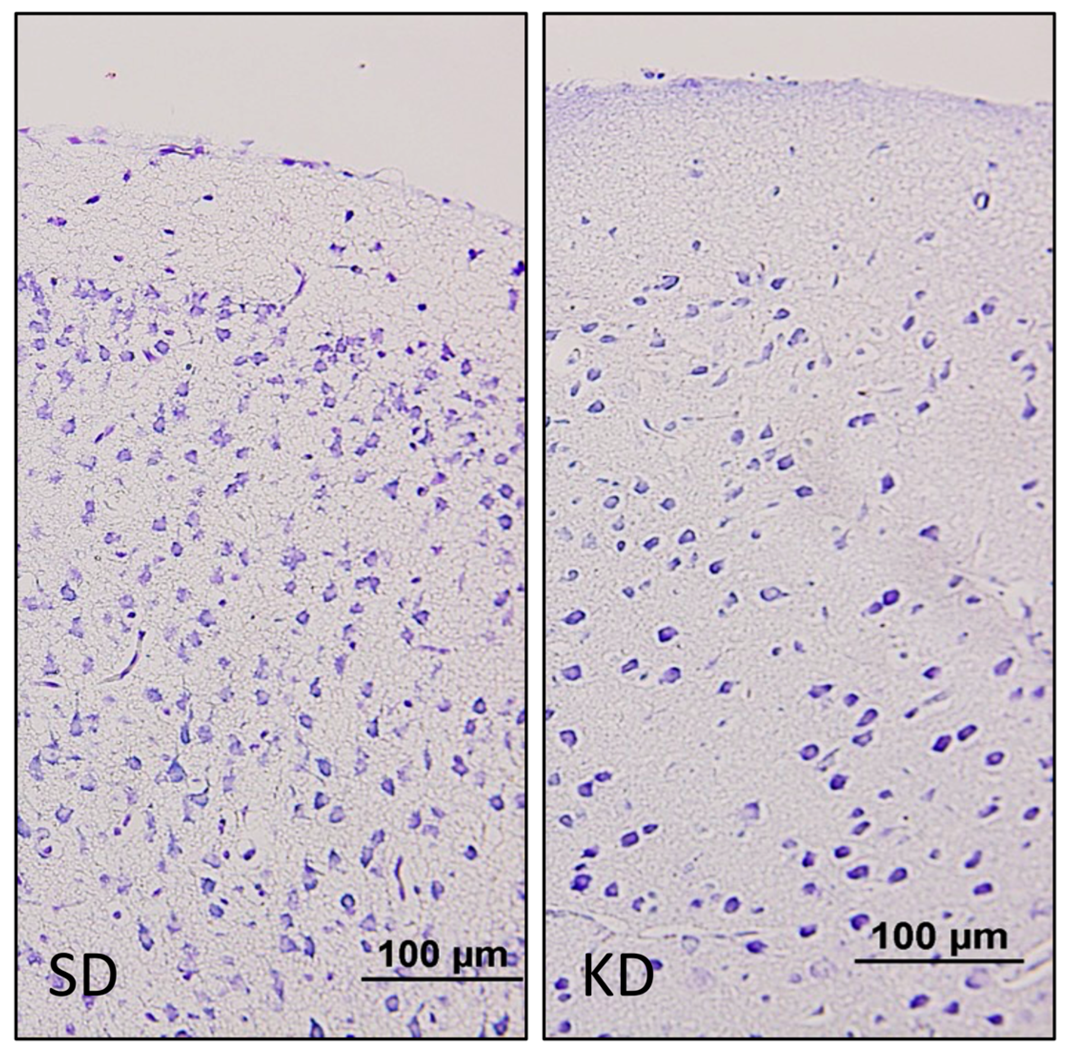 Nutrients 15 01994 g002 Nutrients 15 01994 g002