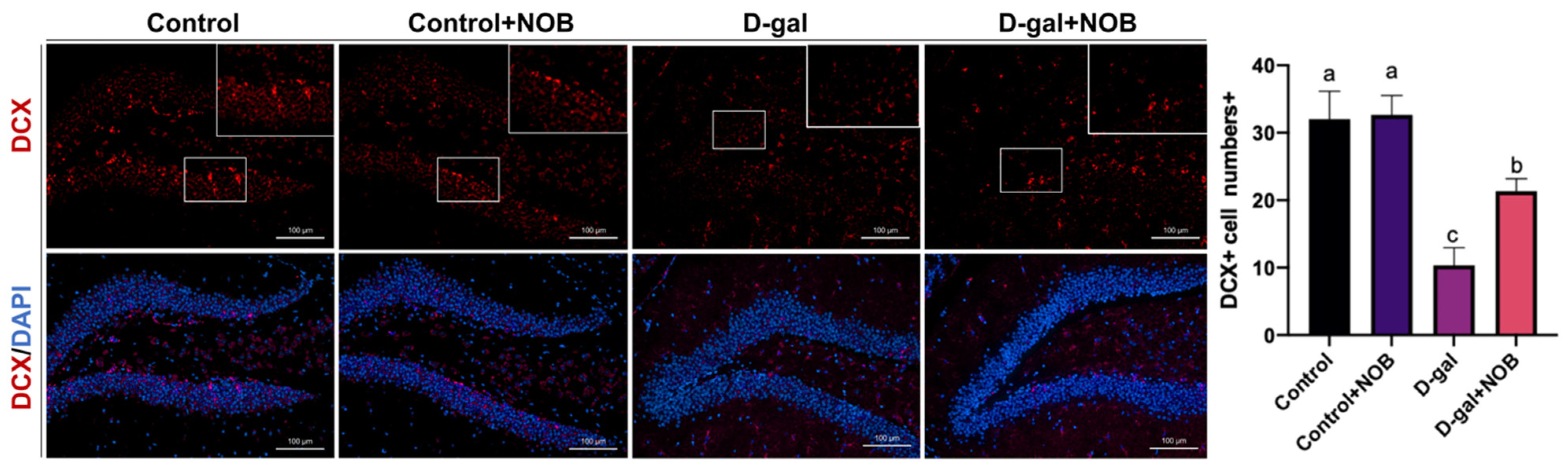 Nutrients 15 02228 g004