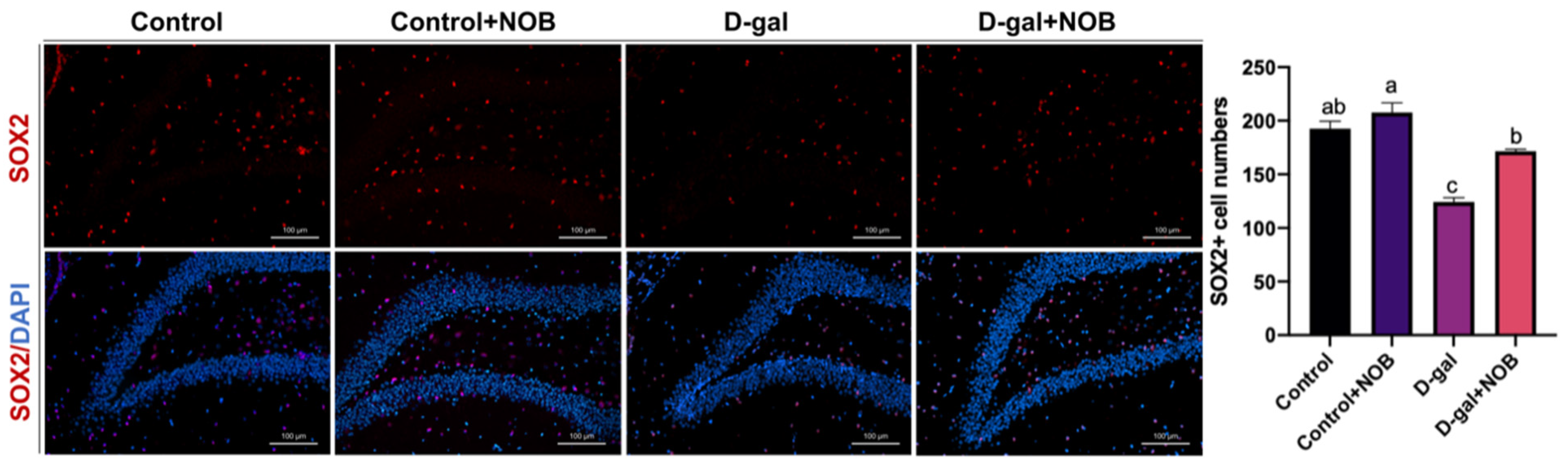 Nutrients 15 02228 g005