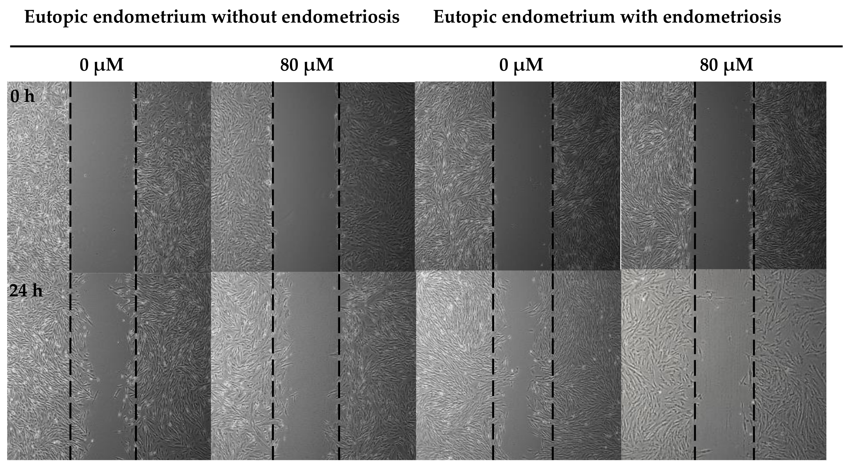 Nutrients 15 03001 g004a