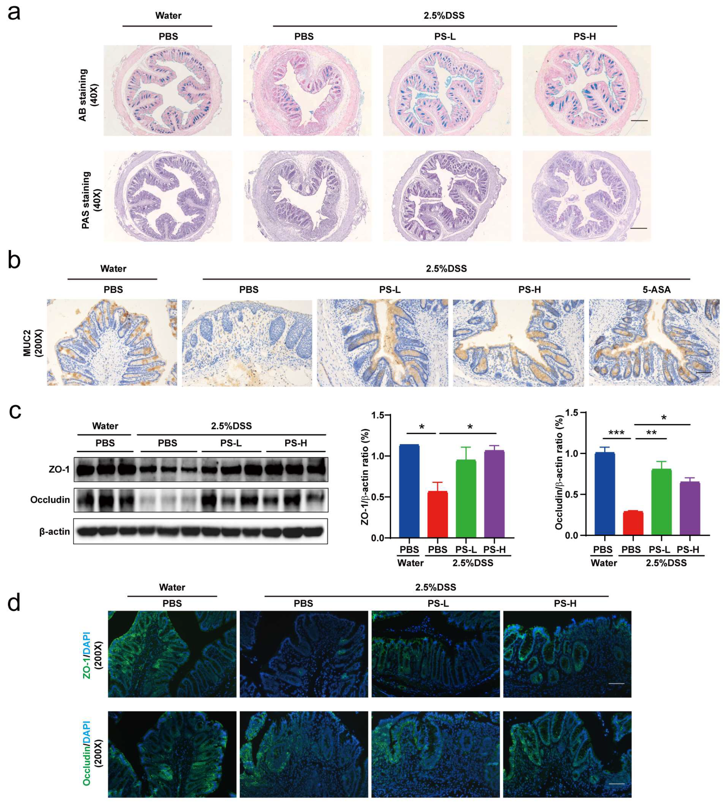 Nutrients 15 03054 g004a Nutrients 15 03054 g004a
