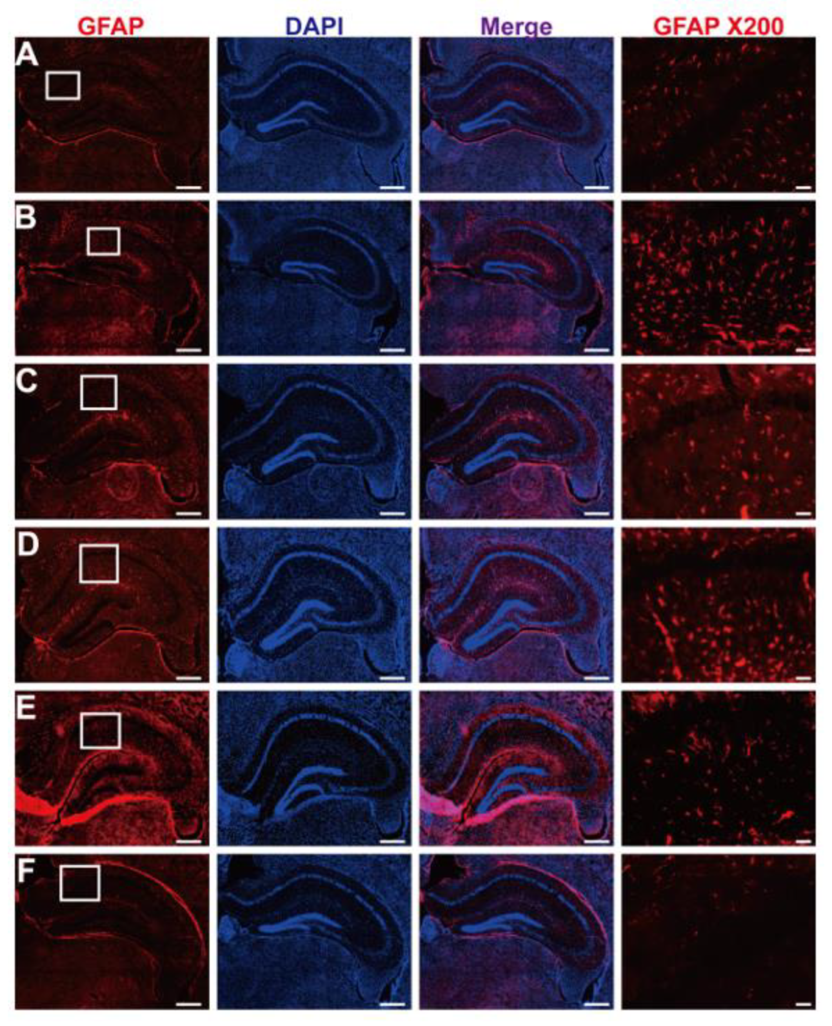 Nutrients 15 03389 g011 Nutrients 15 03389 g011