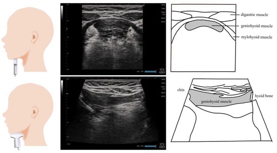 Nutrients 15 03560 g001