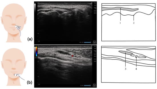 Nutrients 15 03560 g008