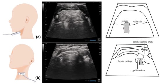 Nutrients 15 03560 g011