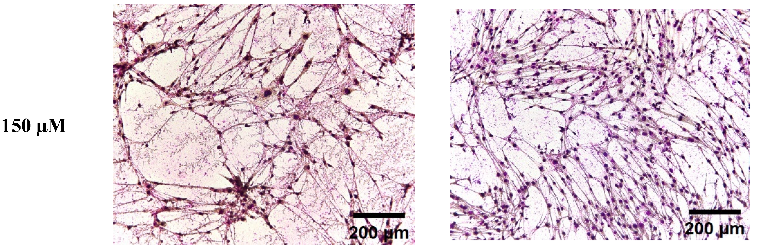 Nutrients 16 00706 g002b