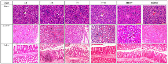 Nutrients 16 01356 g003b