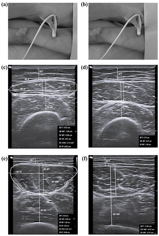 Nutrients 16 01496 g0a1