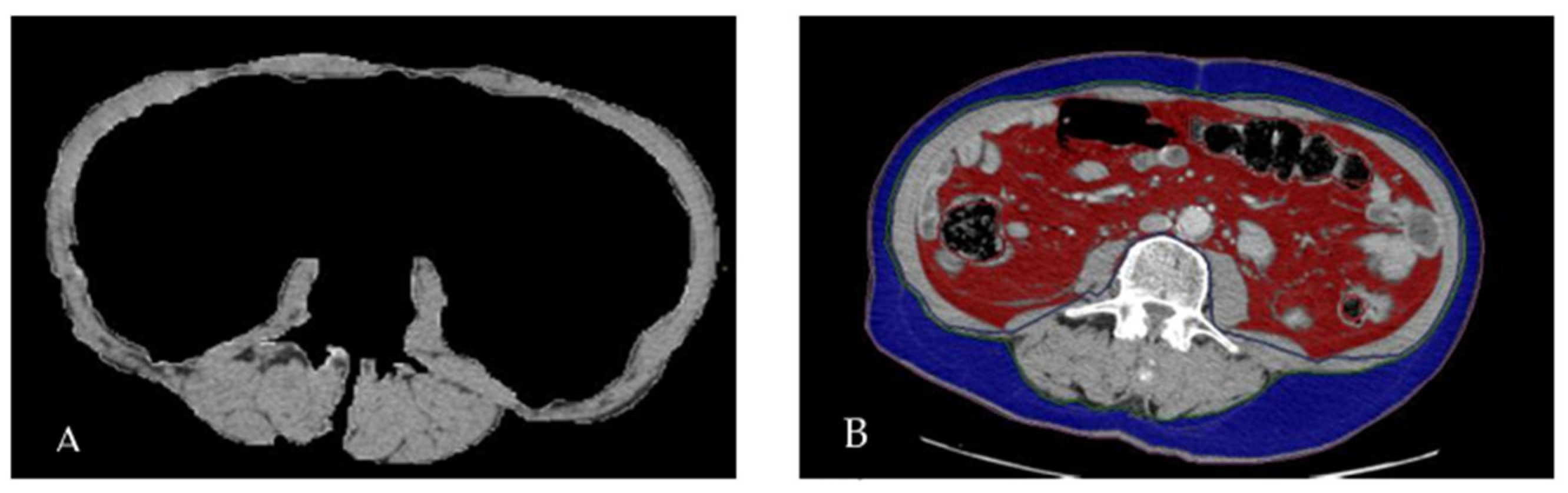 Nutrients 16 01834 g001