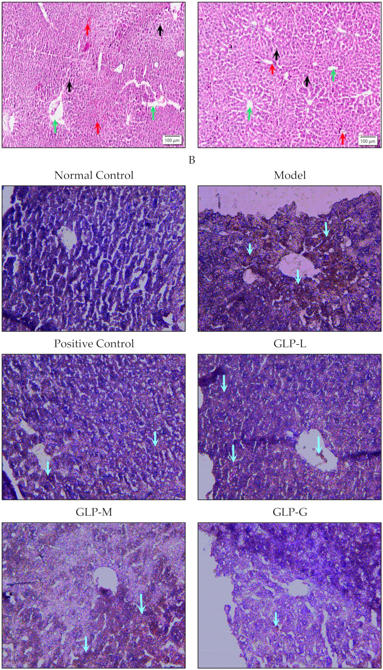 Nutrients 16 01859 g003b