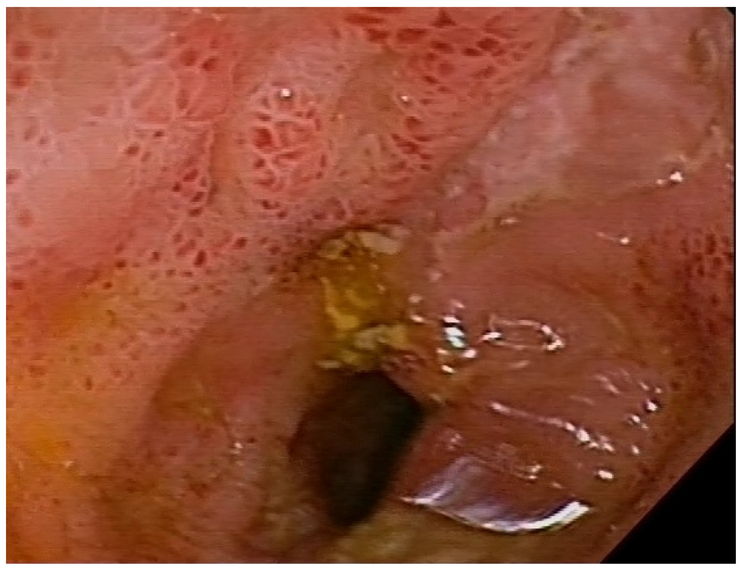 Nutrients 17 00074 g004