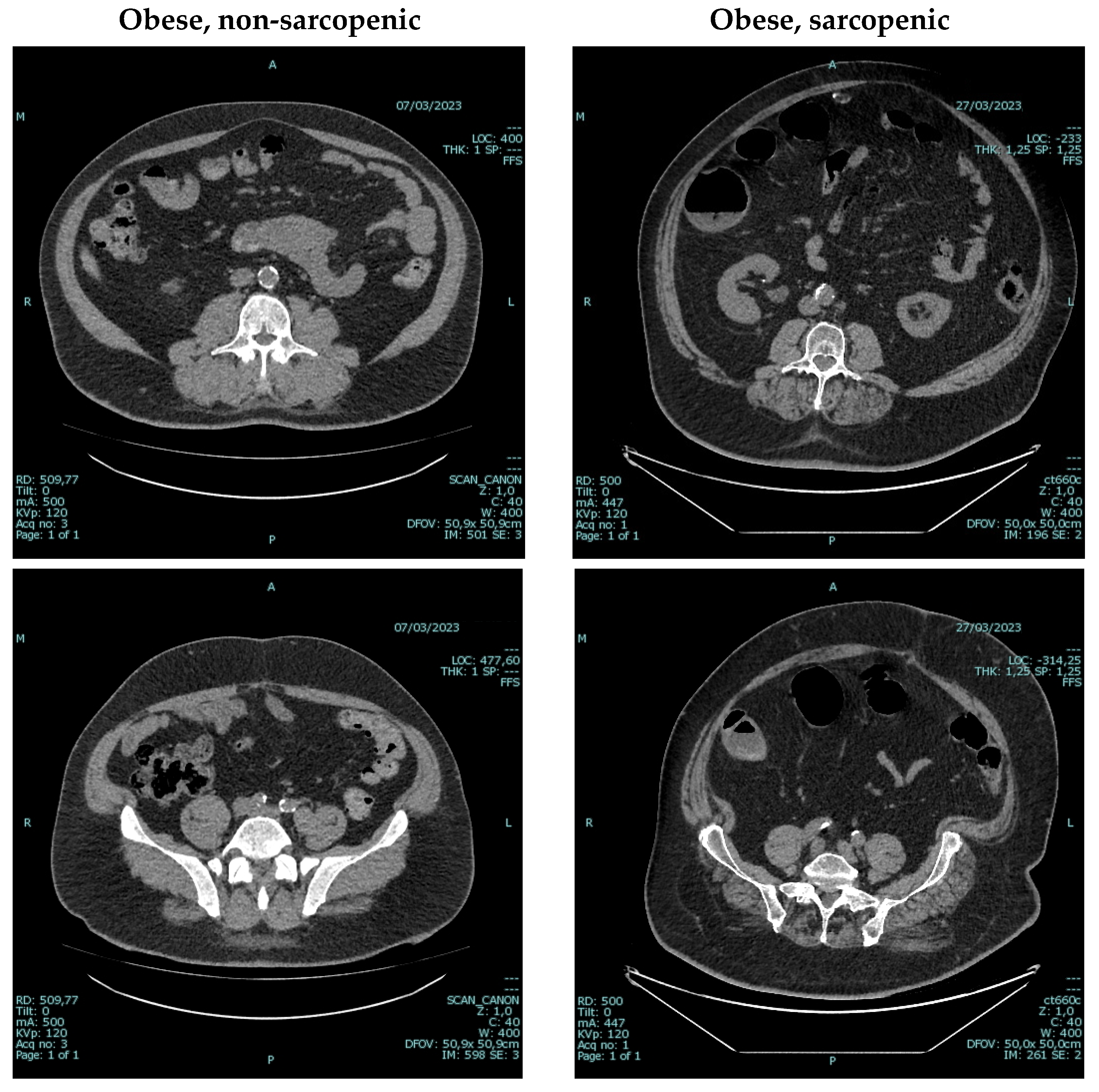 Nutrients 17 02002 g003
