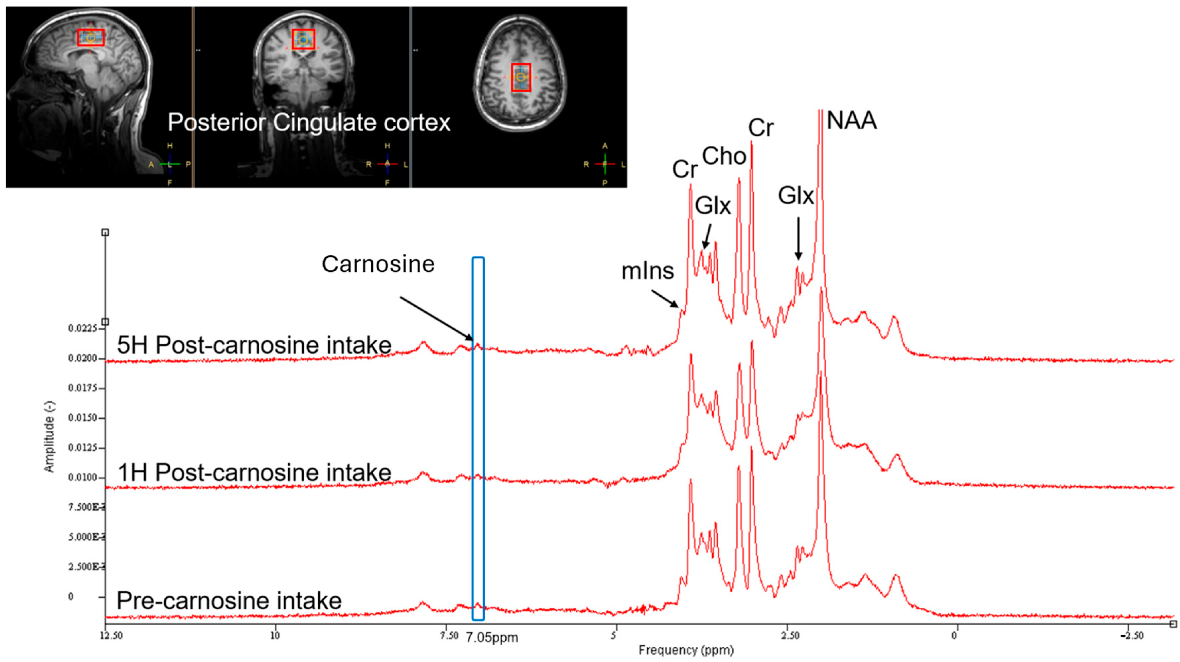 Nutrients 17 02130 g001