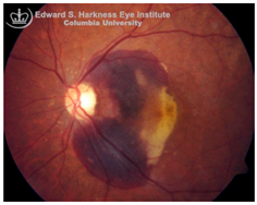 Nutrients 17 02964 i006 Nutrients 17 02964 i006