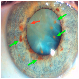 Nutrients 17 02964 i007 Nutrients 17 02964 i007