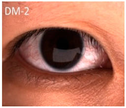 Nutrients 17 02964 i009 Nutrients 17 02964 i009