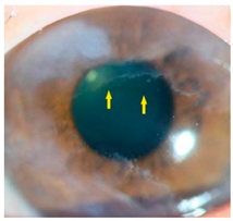 Nutrients 17 02964 i013 Nutrients 17 02964 i013