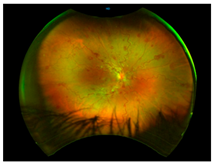 Nutrients 17 02964 i016 Nutrients 17 02964 i016