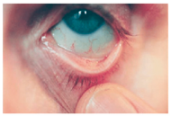 Nutrients 17 02964 i017 Nutrients 17 02964 i017