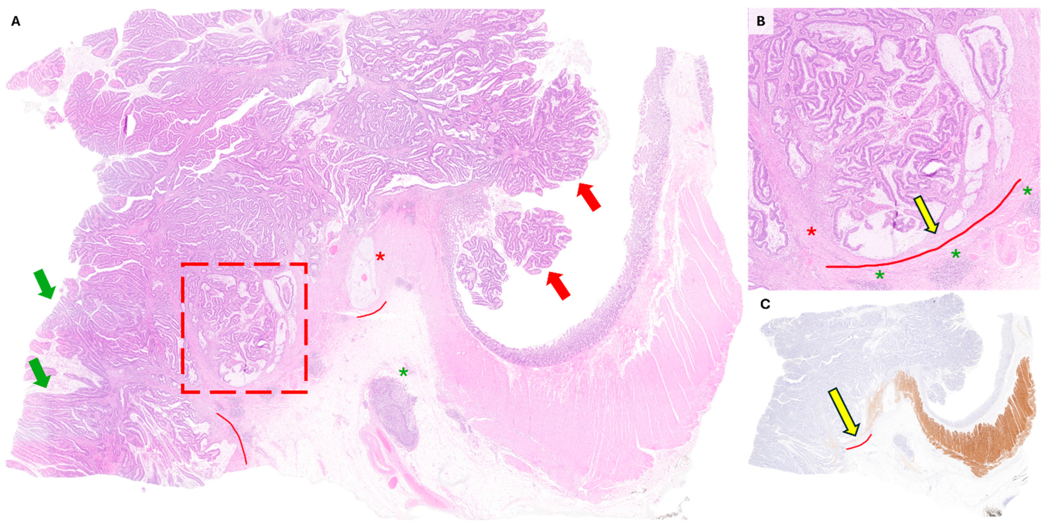 Onco 05 00039 g001 Onco 05 00039 g001