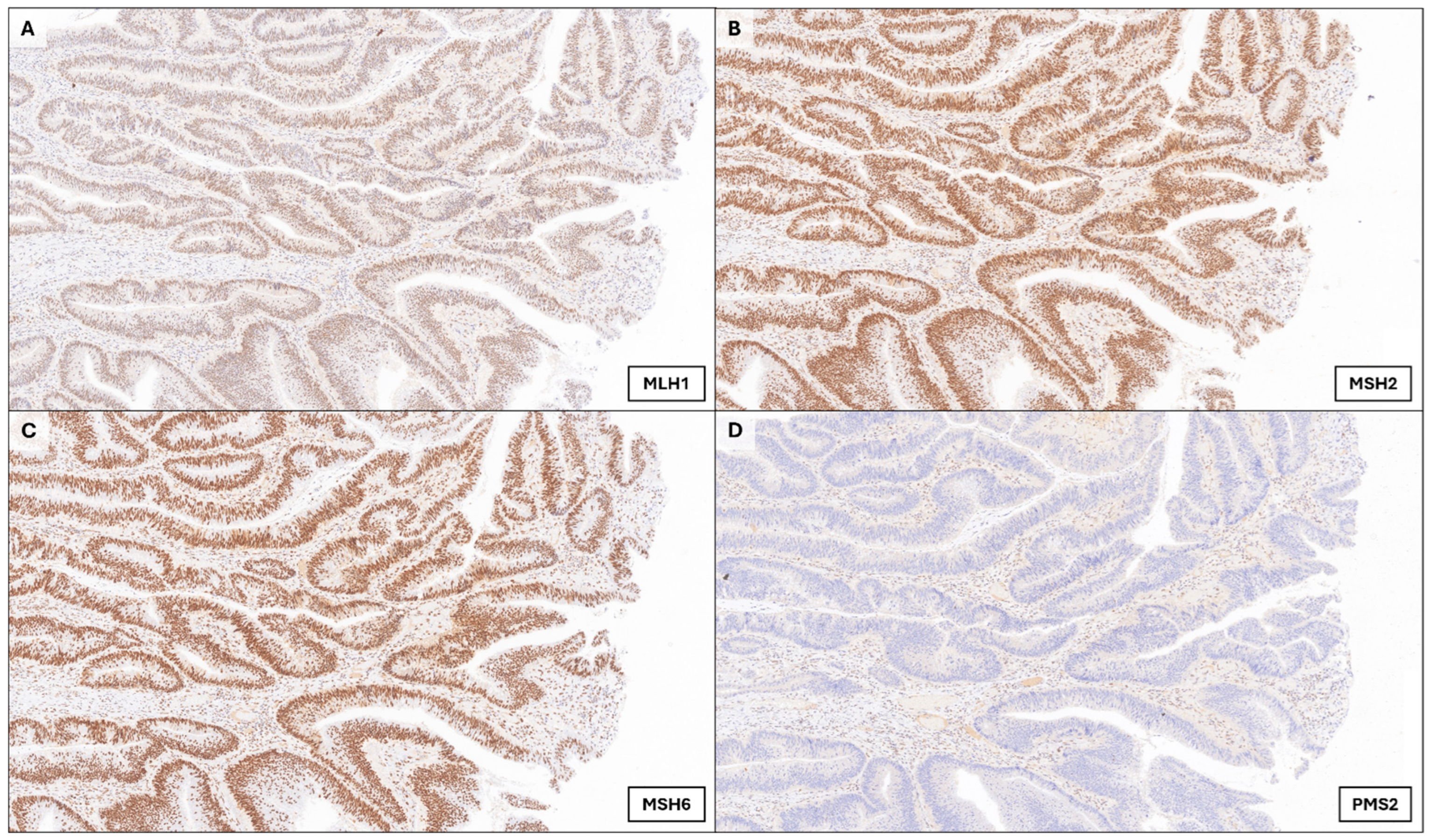 Onco 05 00039 g002 Onco 05 00039 g002