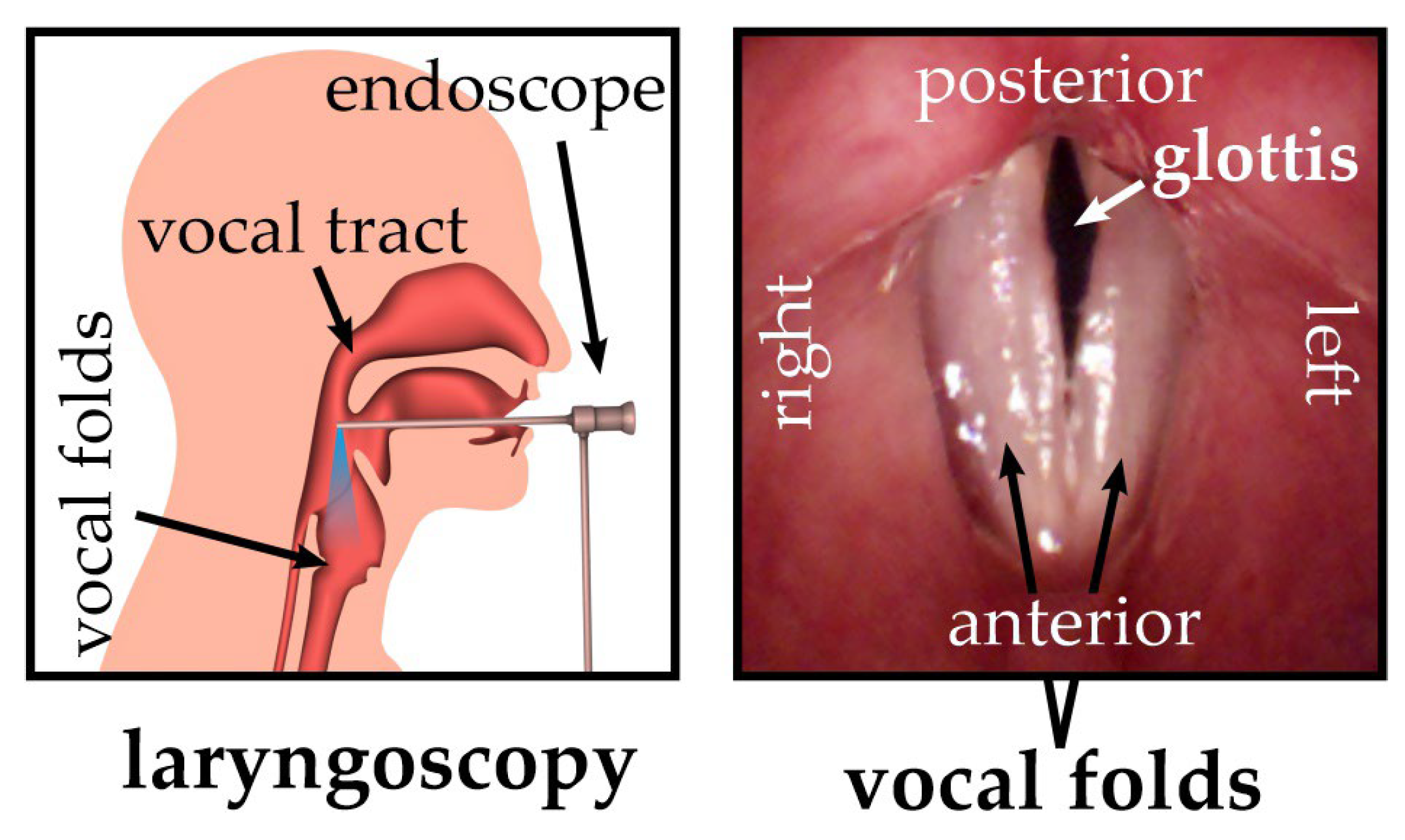Optics 06 00010 g001