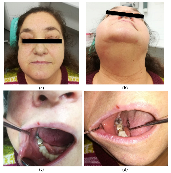 Oral 01 00015 g001 Oral 01 00015 g001