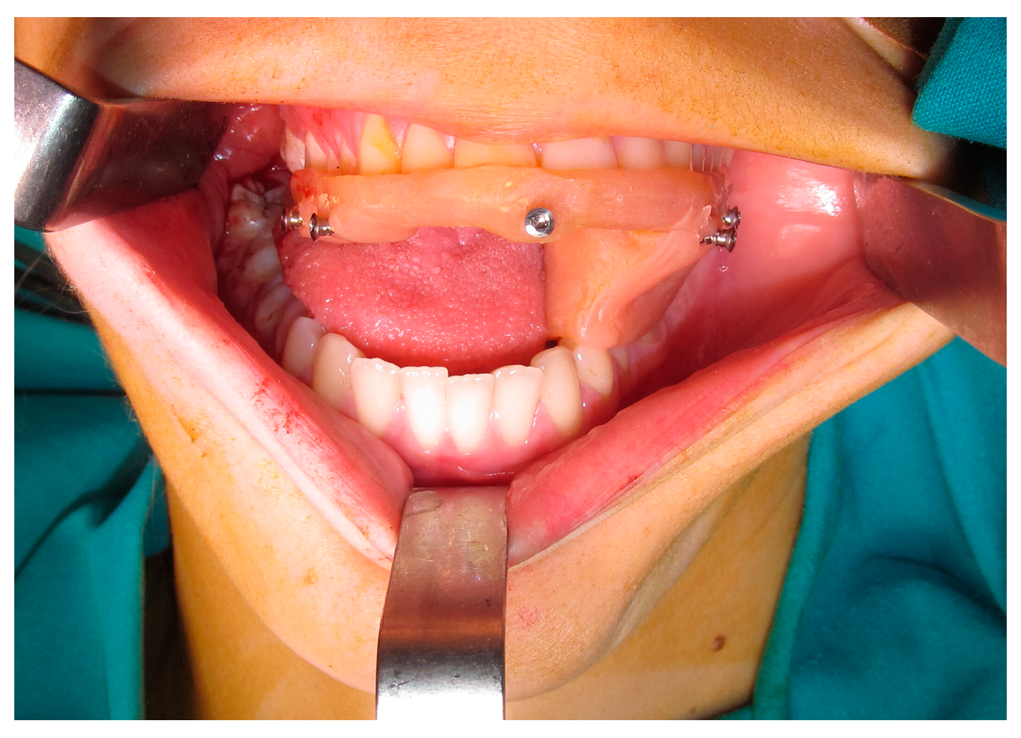 Oral 03 00013 g004 Oral 03 00013 g004