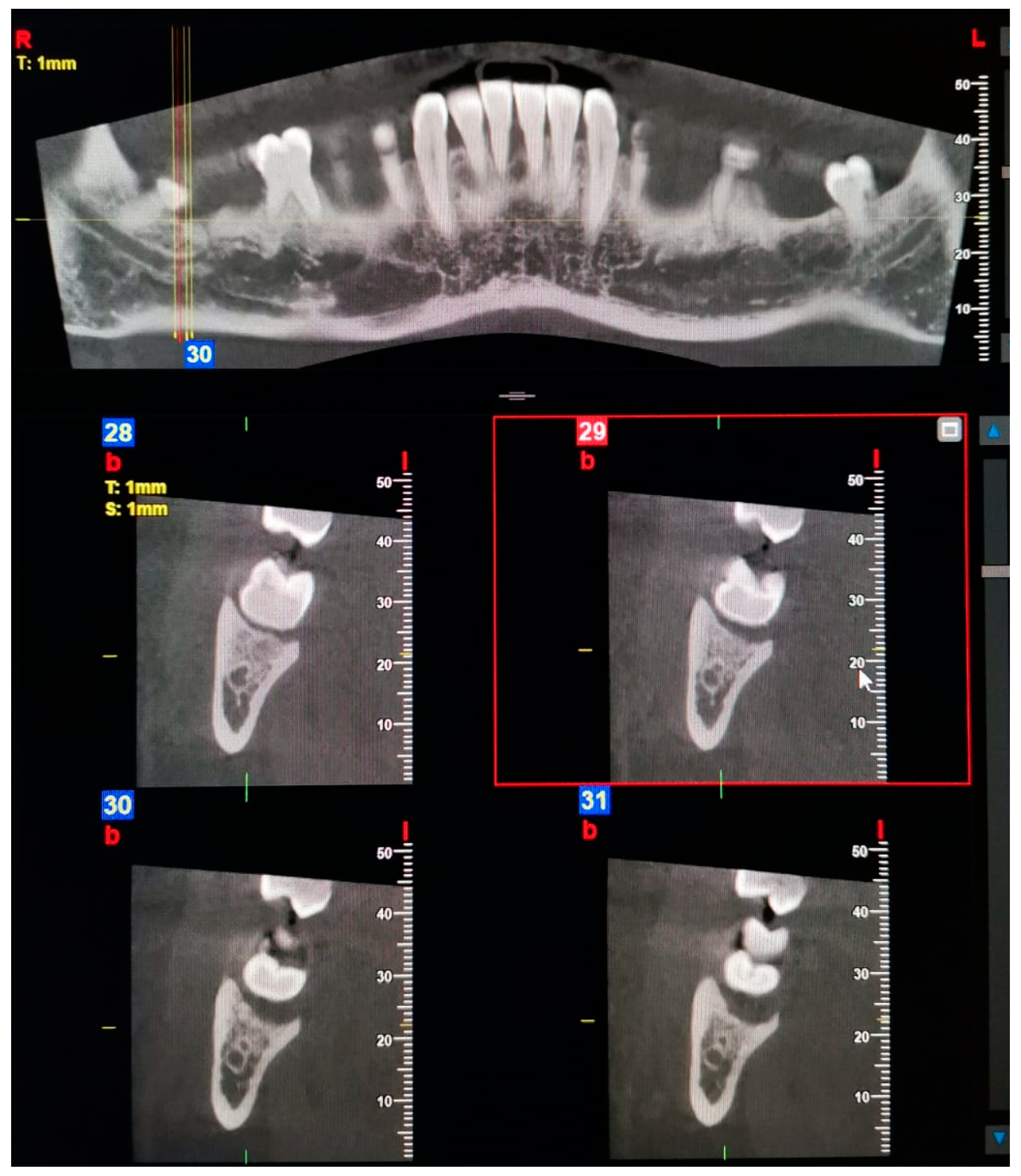 Oral 03 00022 g002 Oral 03 00022 g002