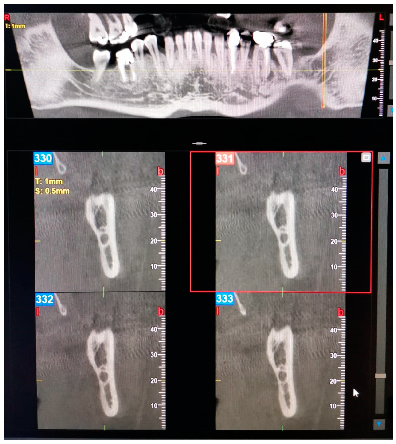 Oral 03 00022 g003 Oral 03 00022 g003