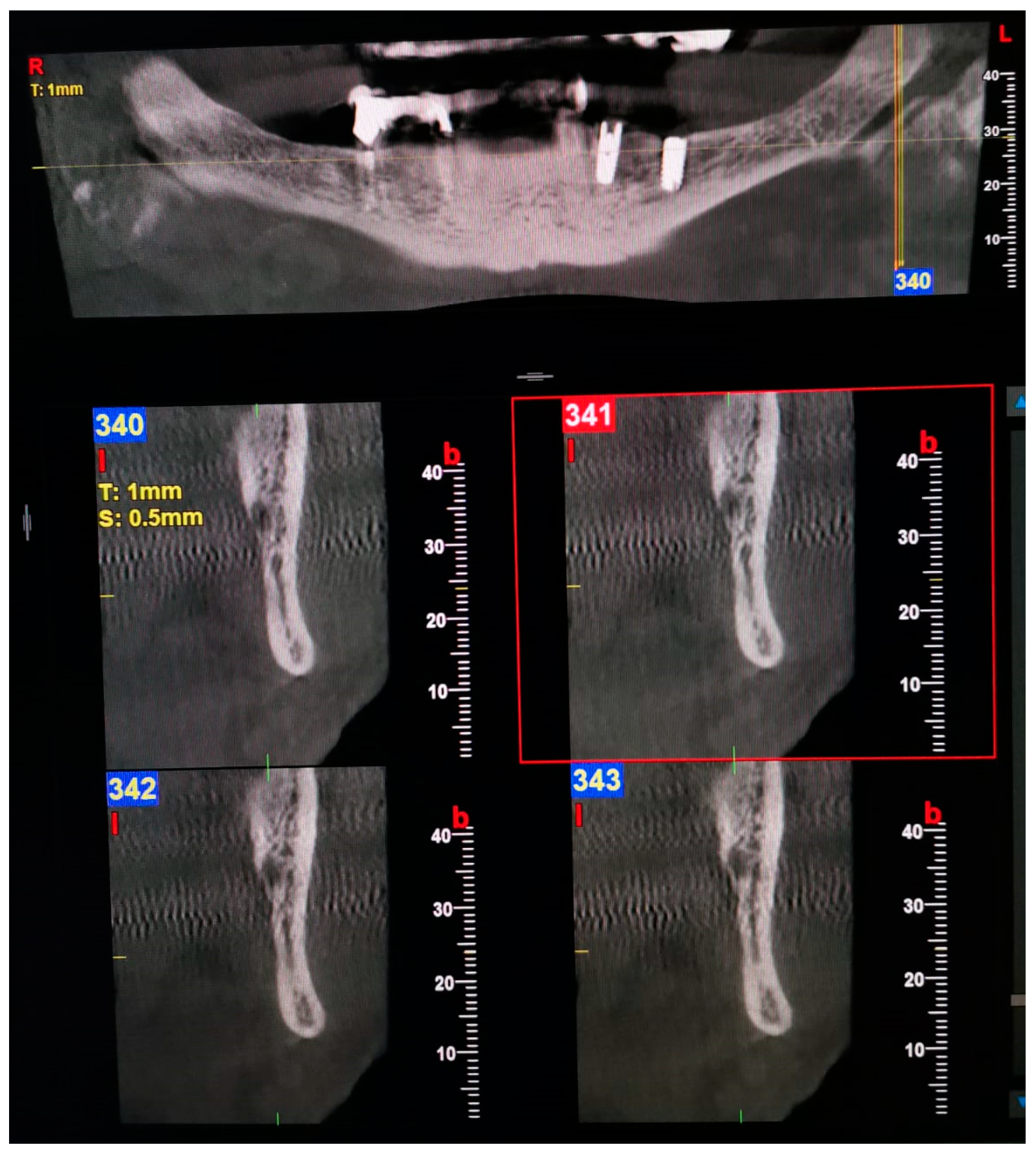 Oral 03 00022 g004 Oral 03 00022 g004