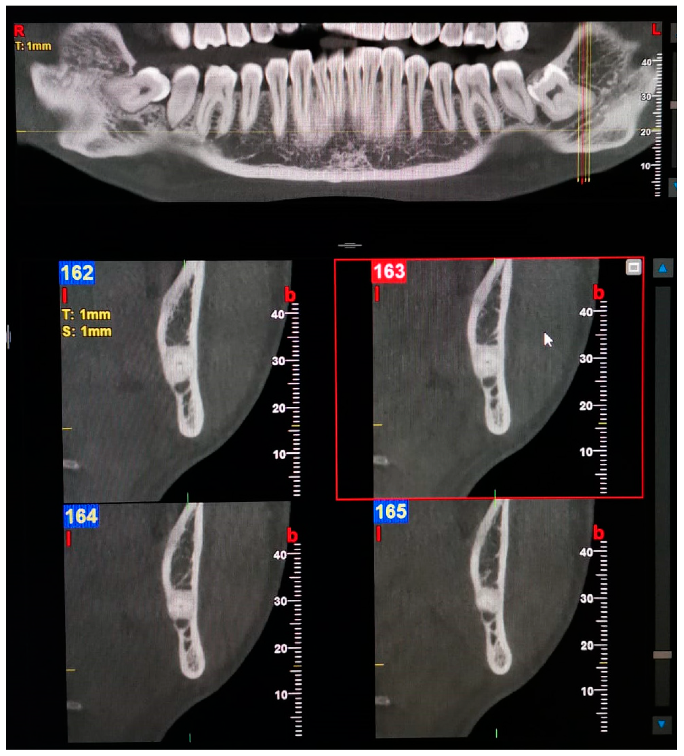 Oral 03 00022 g006 Oral 03 00022 g006