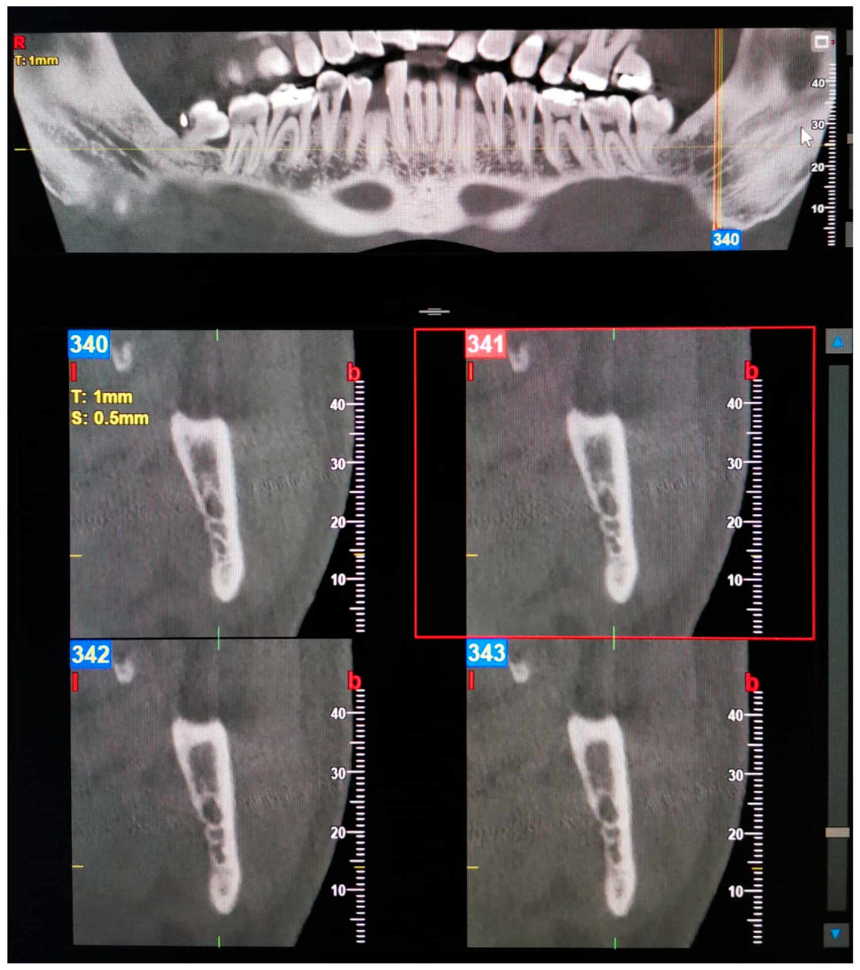 Oral 03 00022 g007 Oral 03 00022 g007