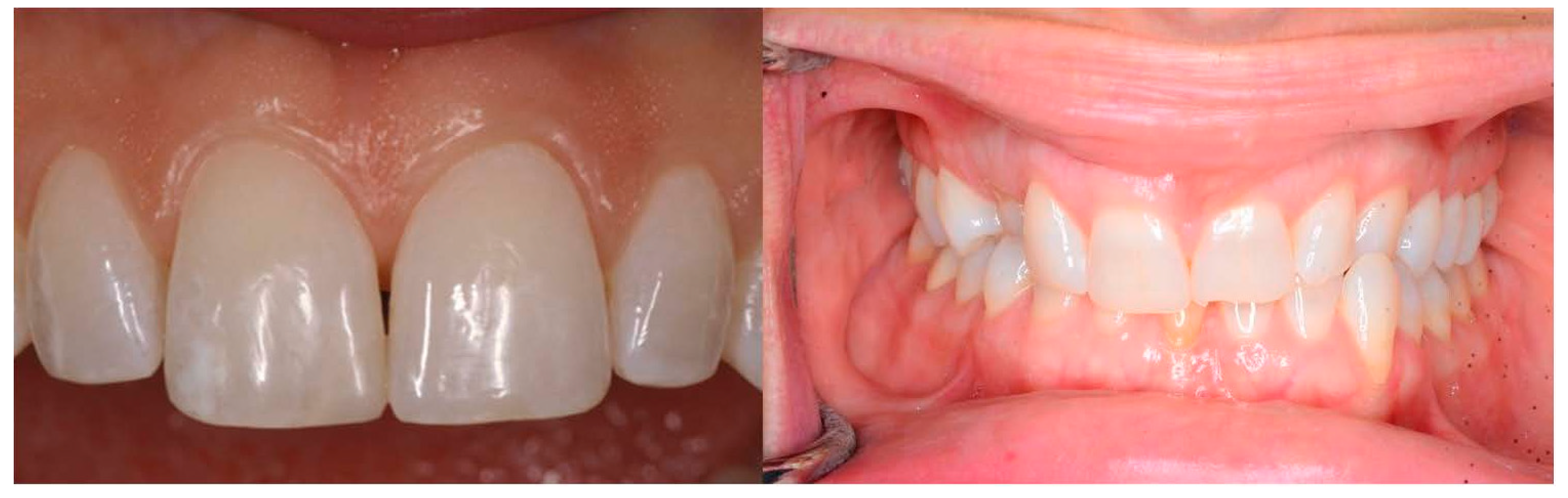 Oral 04 00001 g001