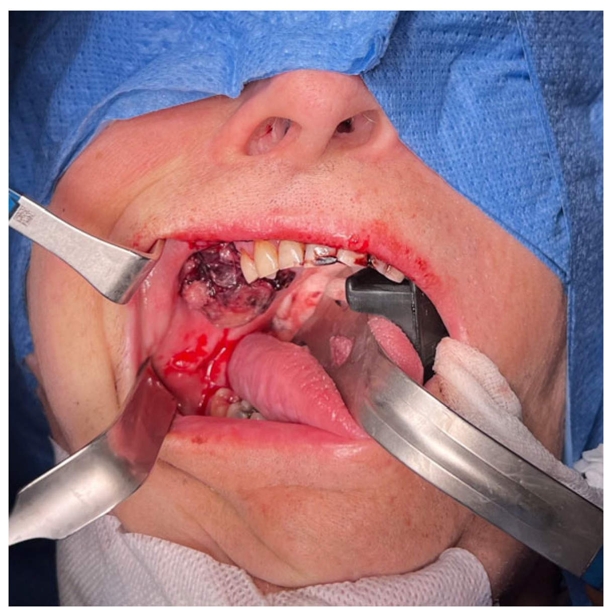 Oral 04 00029 g001 Oral 04 00029 g001
