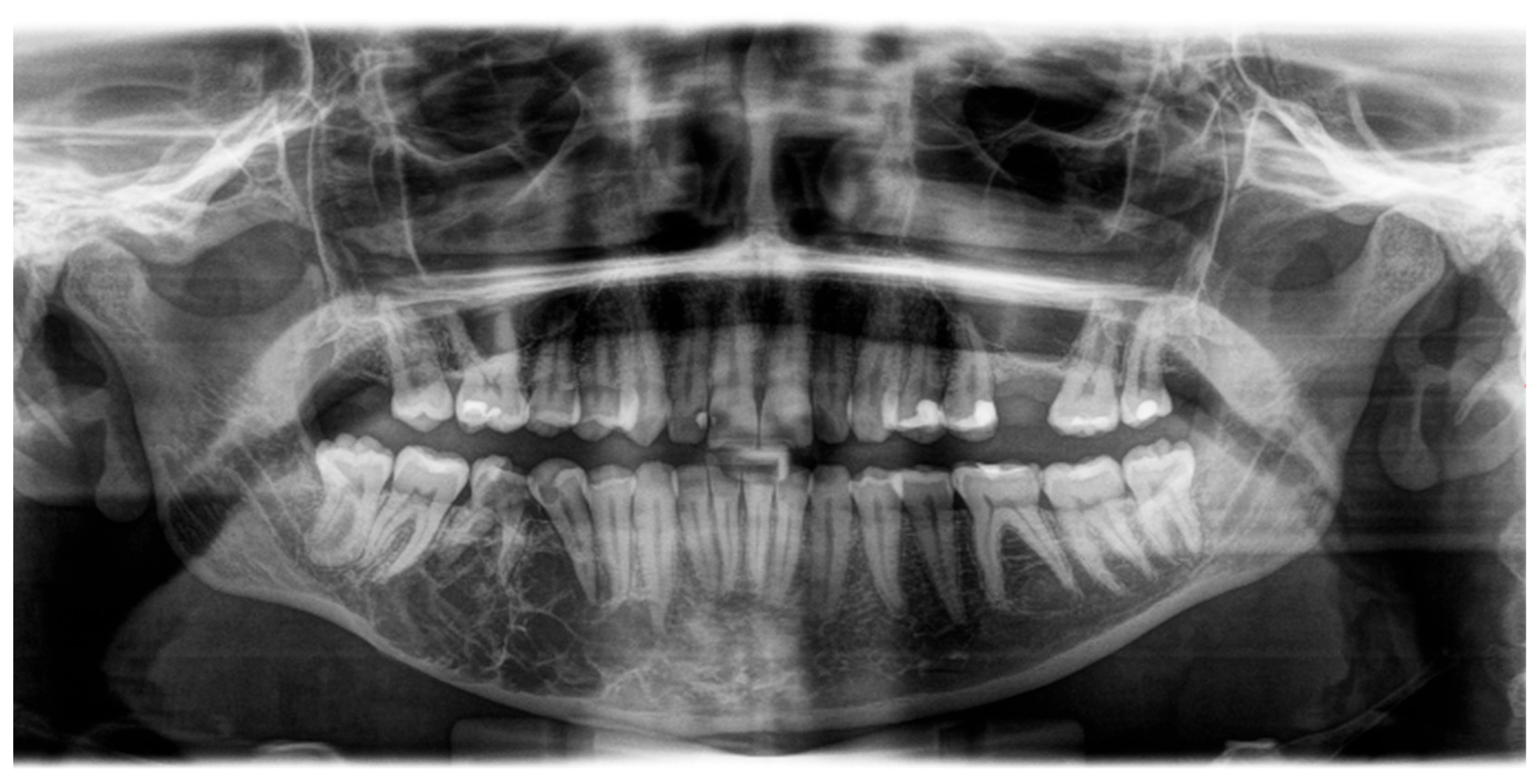 Oral 05 00039 g001 Oral 05 00039 g001