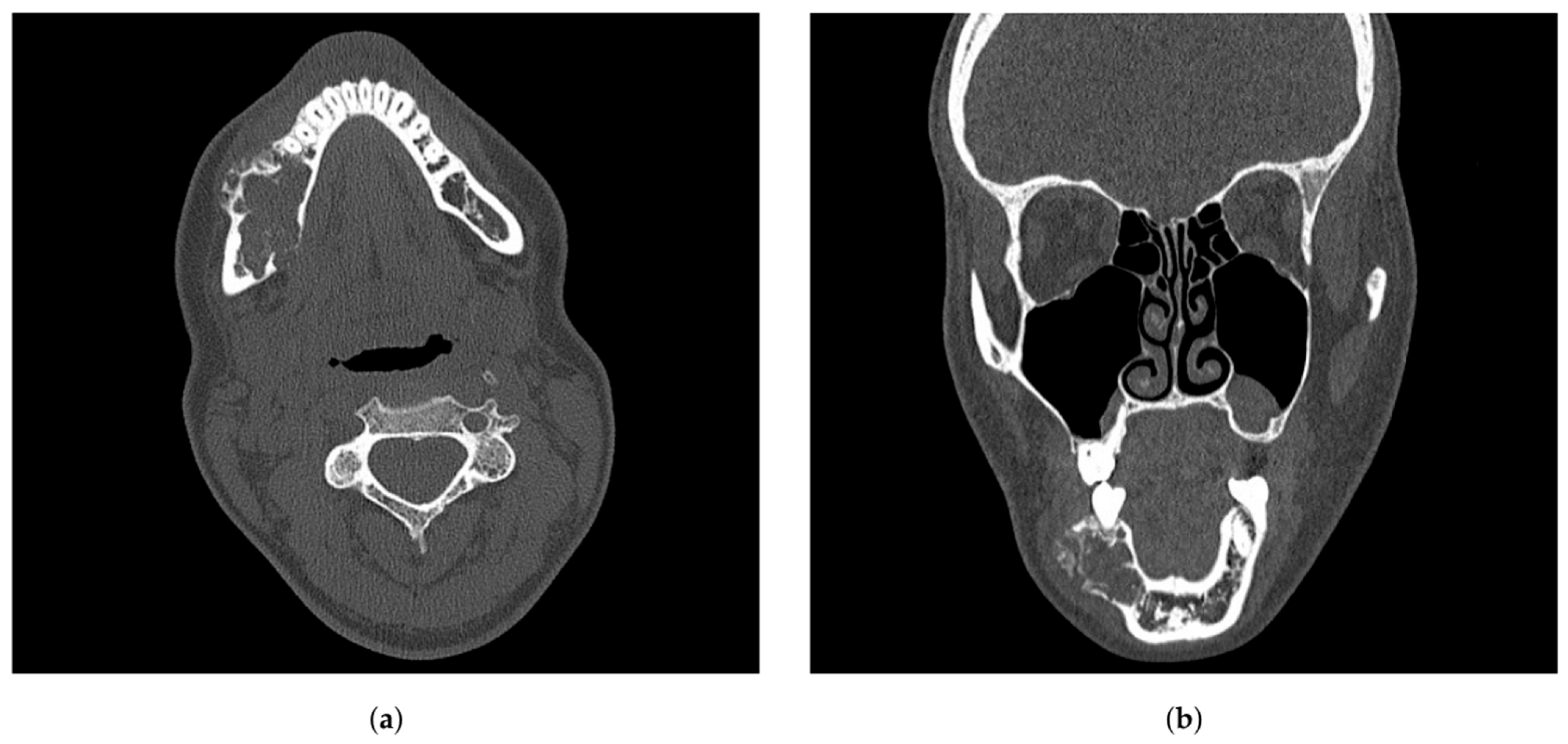 Oral 05 00039 g002 Oral 05 00039 g002