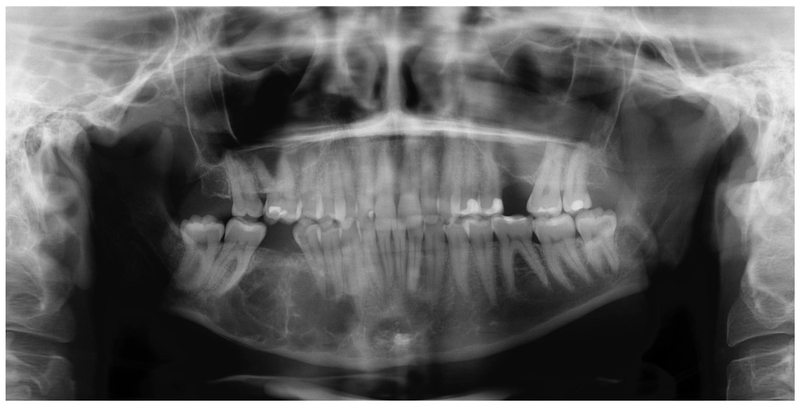 Oral 05 00039 g004 Oral 05 00039 g004