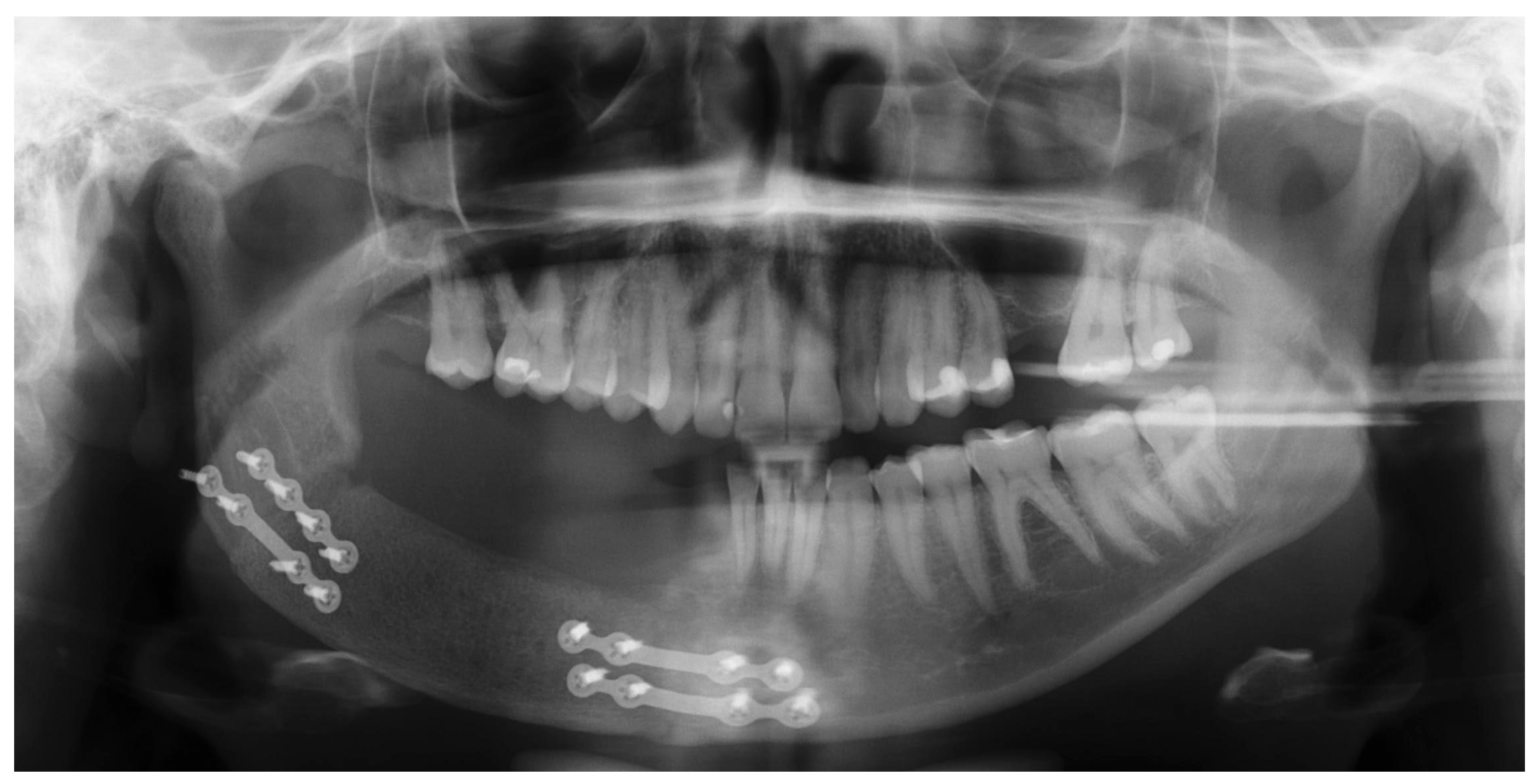 Oral 05 00039 g008 Oral 05 00039 g008