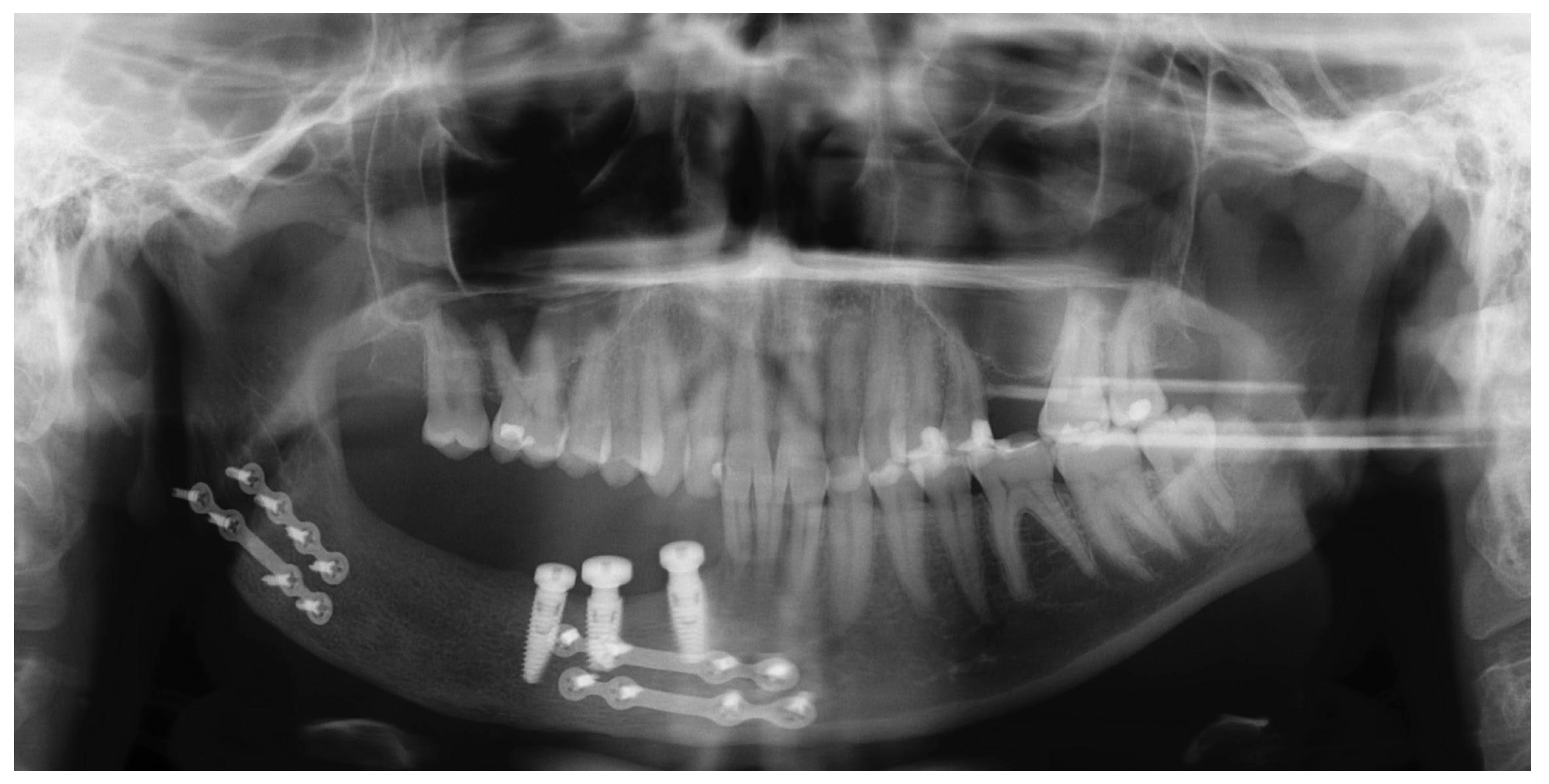 Oral 05 00039 g009 Oral 05 00039 g009