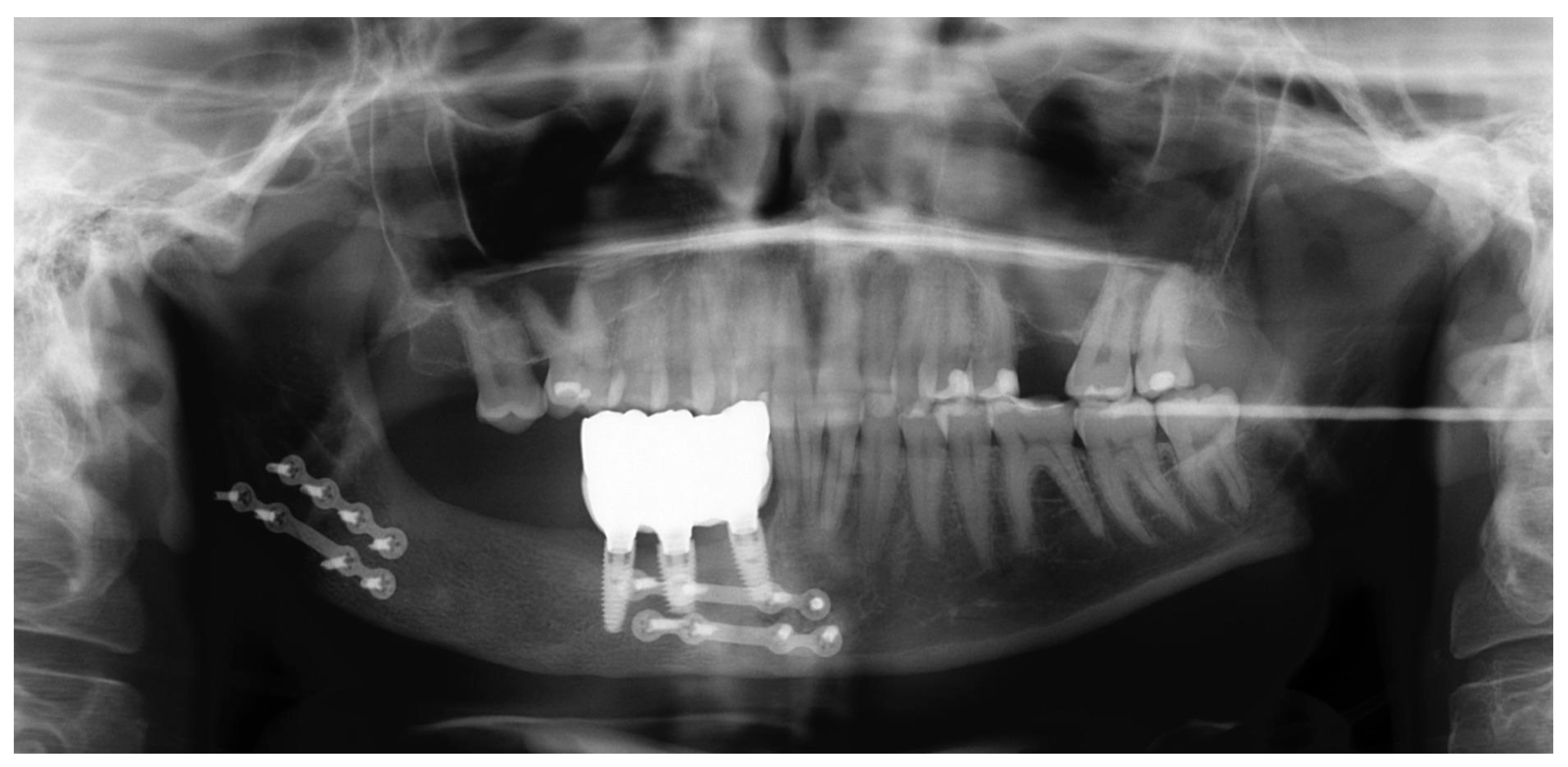 Oral 05 00039 g010 Oral 05 00039 g010