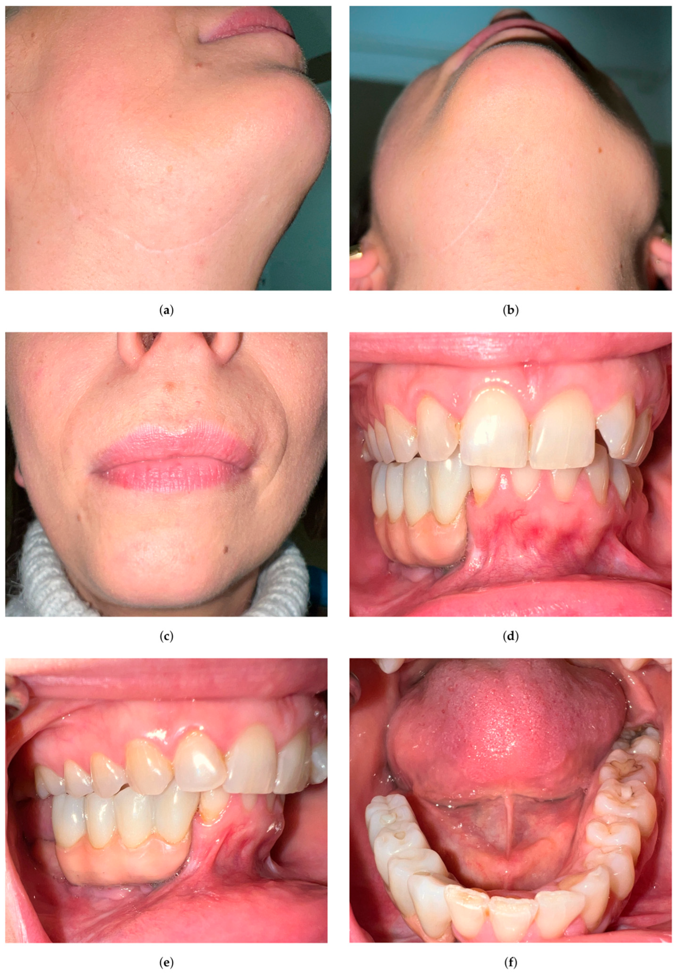 Oral 05 00039 g011 Oral 05 00039 g011