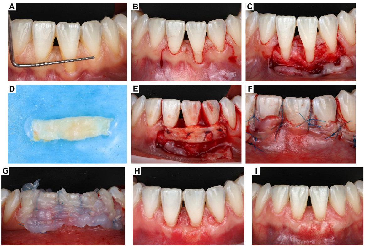 Oral 05 00053 g001 Oral 05 00053 g001