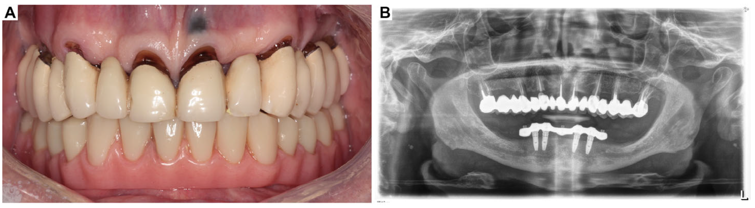 Oral 05 00053 g002 Oral 05 00053 g002