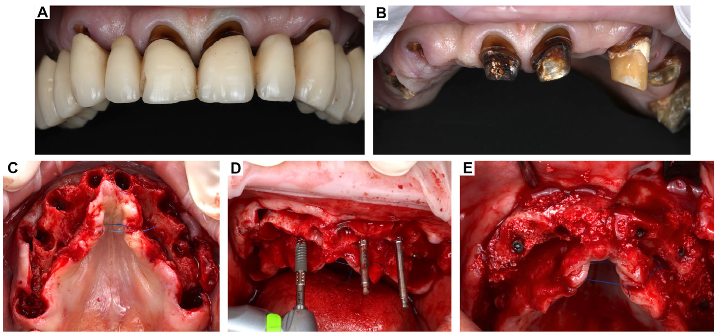 Oral 05 00053 g003 Oral 05 00053 g003