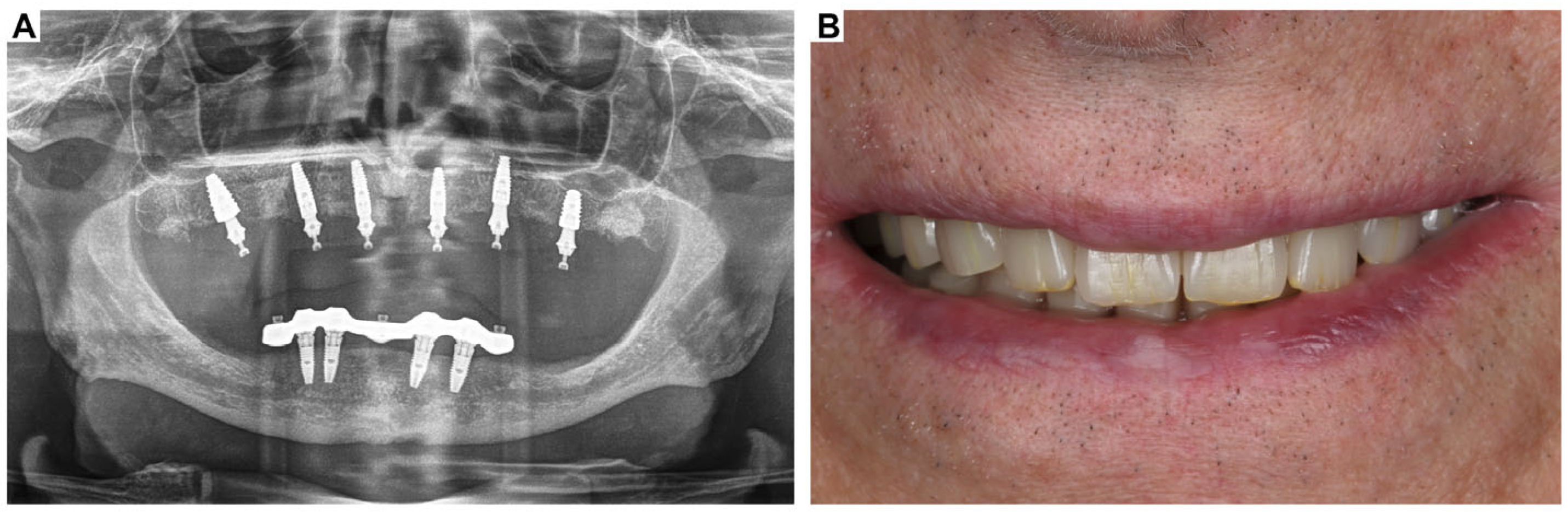 Oral 05 00053 g004 Oral 05 00053 g004