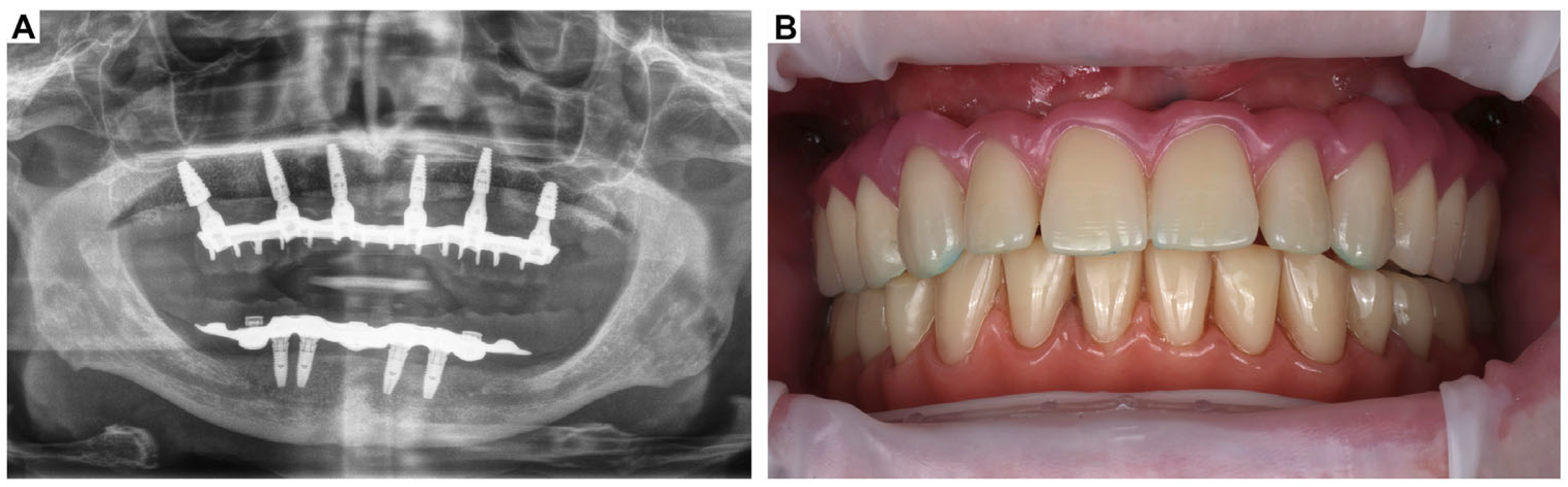 Oral 05 00053 g006 Oral 05 00053 g006