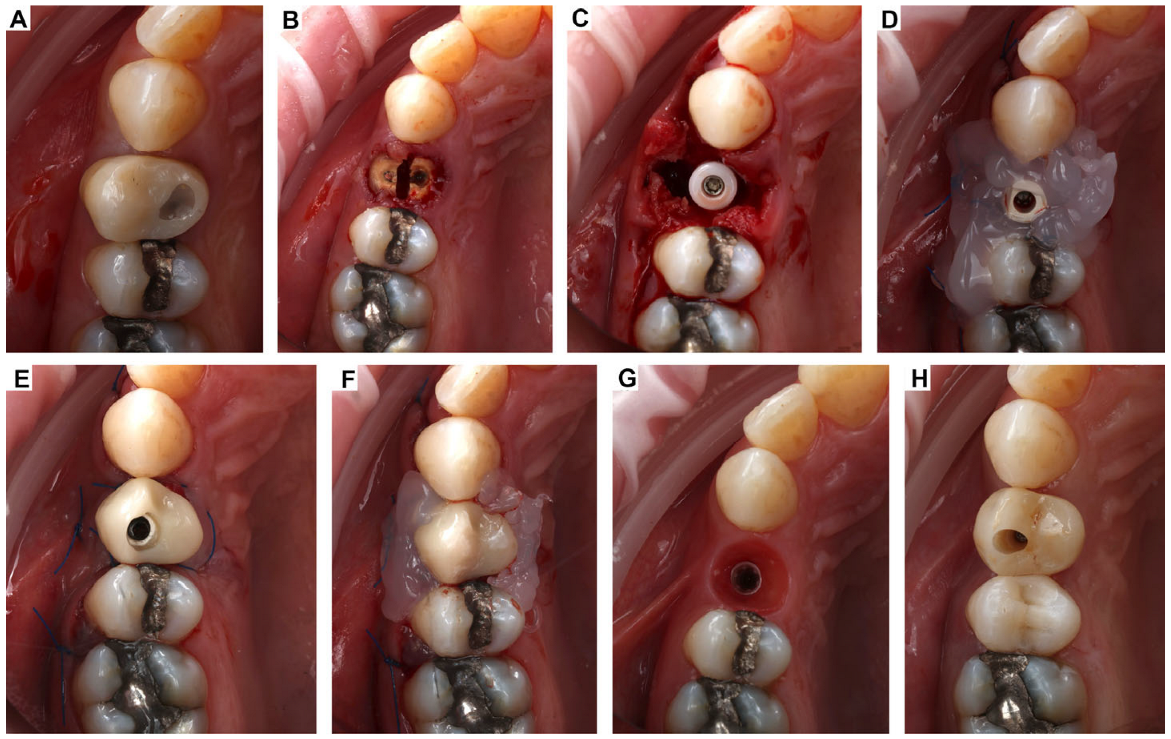 Oral 05 00053 g008 Oral 05 00053 g008