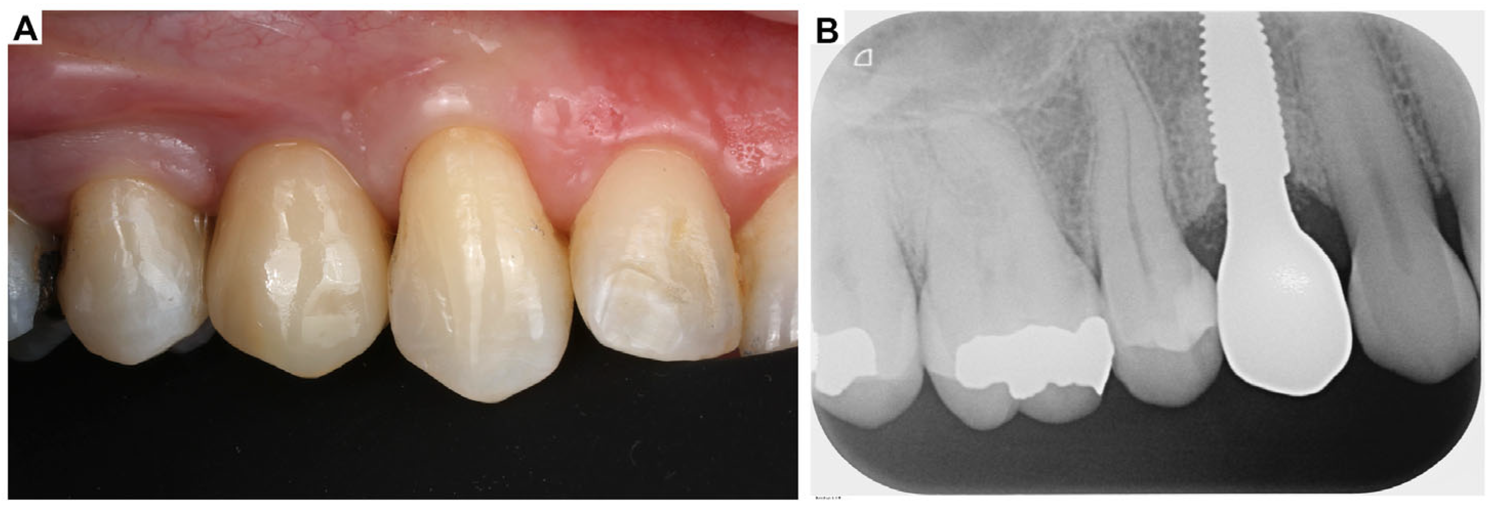 Oral 05 00053 g009 Oral 05 00053 g009