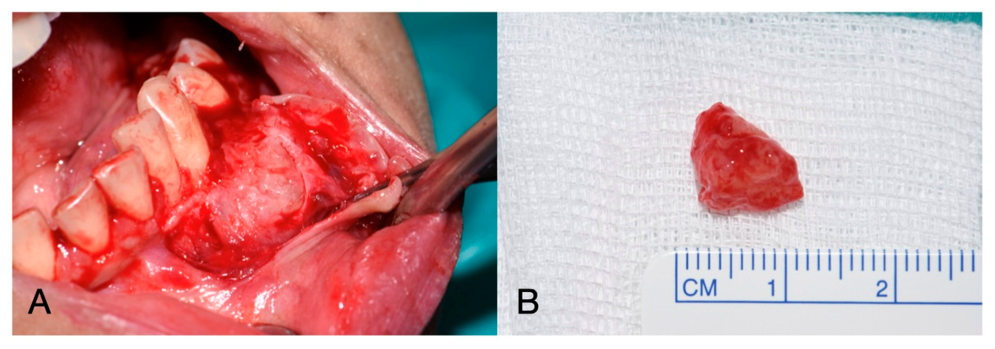 Oral 05 00057 g003 Oral 05 00057 g003